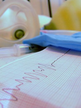 Los nuevos datos ayudarán a los médicos a tratar con mayor precisión disfunciones cardíacas / Kalshassan.